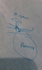 Anesthesiologist's artwork, explaining to me one of the patient's possible diagnosis